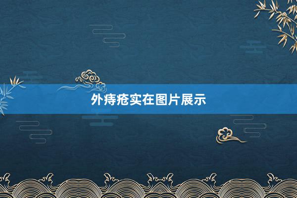 外痔疮实在图片展示